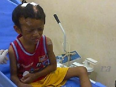 Kronologis Penyiksaan Bocah di Kampar