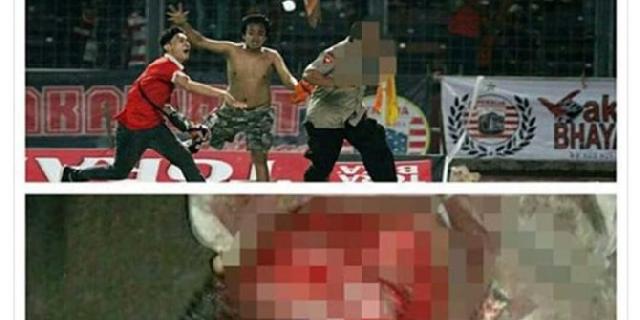 Dikeroyok kelompok Jakmania, mata kiri Brigadir Hanafi buta