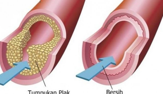 5 Makanan Pembersih Pembuluh Darah