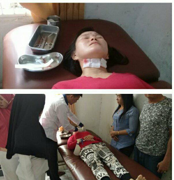 Ngeri, Wanita di Rohil ini Nyaris Tewas Digorok OTK