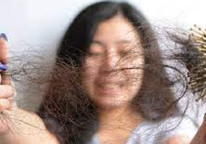 Rambut Banyak yang Rontok, Atasi dengan 5 Cara Ini!