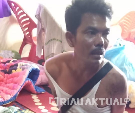 Kepala Dipijak dan Dibanting, Suami Aniaya Istri Hingga Tewas