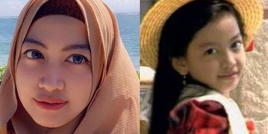 Bekerja Sebagai Dokter, Mantan Penyanyi Cilik Maissy Bagikan Kisah Perjuangan Bertugas ditengah Pand