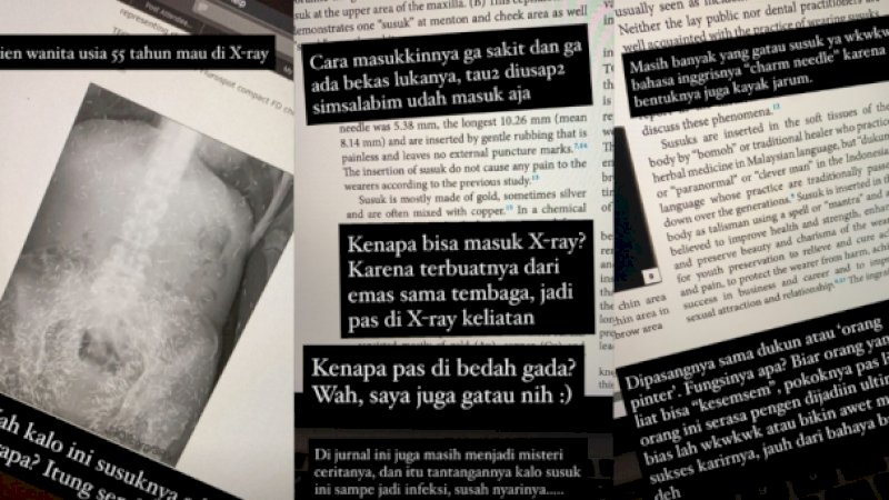 Duh Aneh, Ratusan Susuk Terlihat Jelas di Foto X-ray, Pas Dibedah Tidak Ada