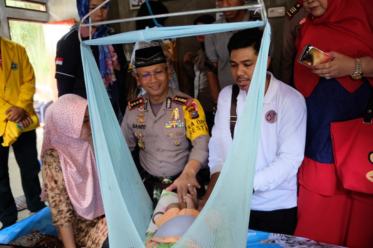 Kasihan Dedek Bayi ini Butuh Bantuan, Delapan Bulan Menderita Tumor