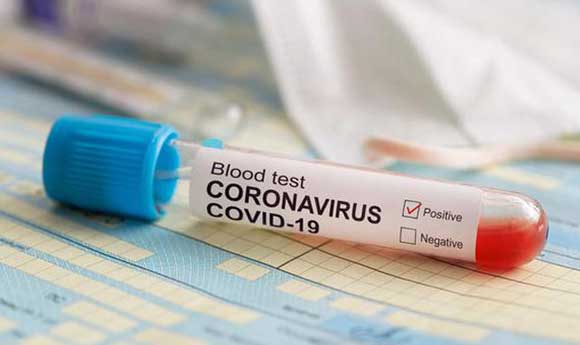 Abi Bahrum Positif Corona, Tokoh Masyarakat Ini Minta Jangan Dijadikan Pencitraan