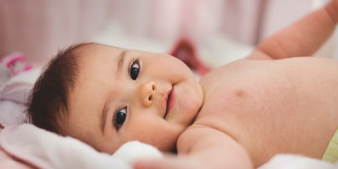 Sunat pada Laki-Laki Sebaiknya Sudah Dilakukan sejak Bayi