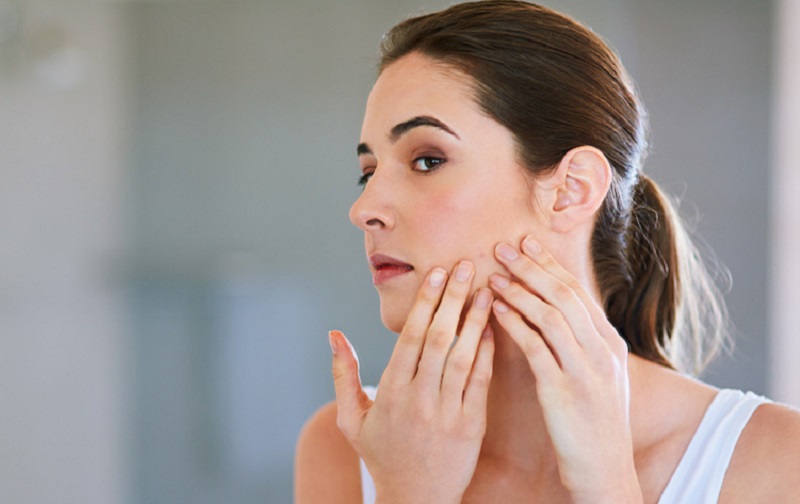 Berikut Tips Merawat Pori-Pori Besar agar Tak Mudah Dimasuki Kotoran