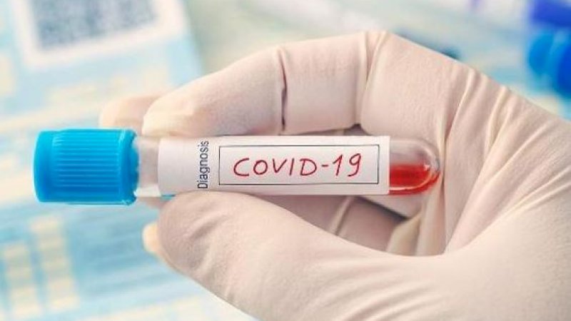 Corona Varian Baru Muncul di Rusia, Lebih Menular Dibanding Delta