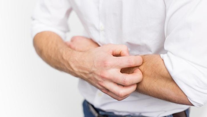 Kenapa Gatal di Kulit Pindah-pindah saat Digaruk? Ini Penjelasan Ilmiahnya