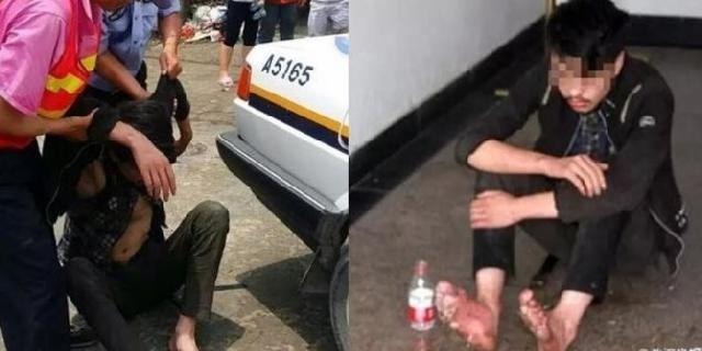 Enam hari main game di warnet, kaki pria ini membusuk