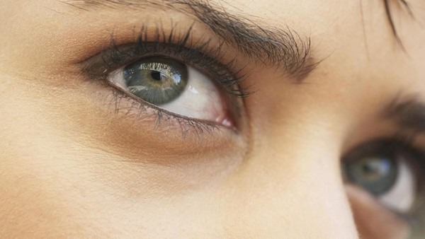 Apa Itu Ptosis? Kondisi 'Mata Ngantuk' yang Ramai Dibahas Warganet