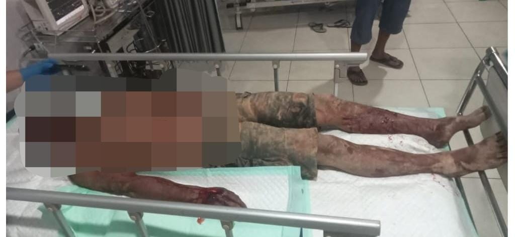 Suami Aniaya Pria yang Diduga Selingkuh dengan Istrinya