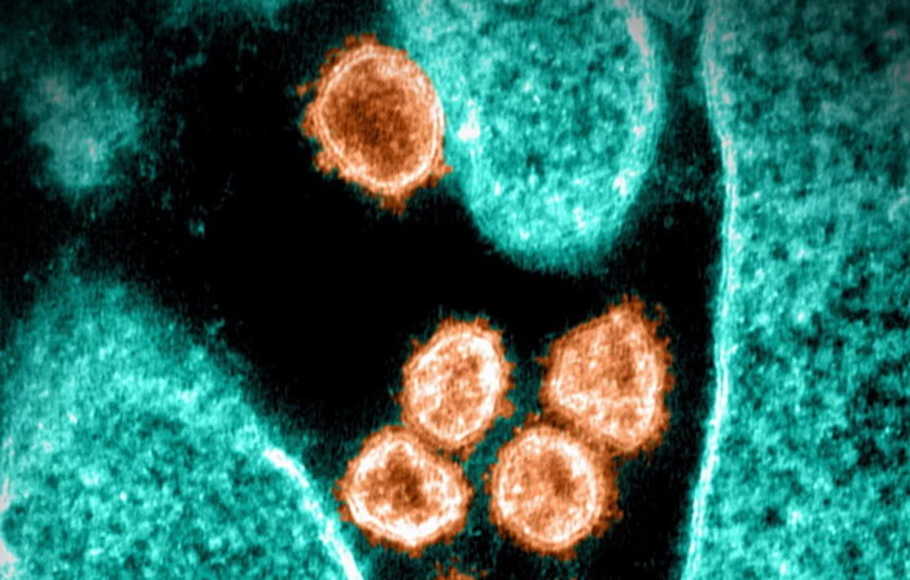 Hasil Studi: Omicron Berkembang di Saluran Pernapasan, Bukan Paru-paru