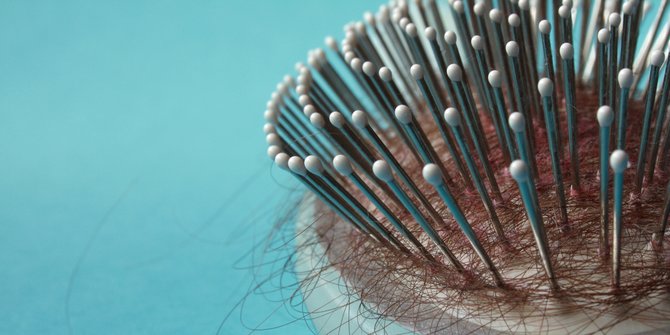 Lima Faktor yang Secara Mengejutkan Bisa Jadi Penyebab Rambut Rontok