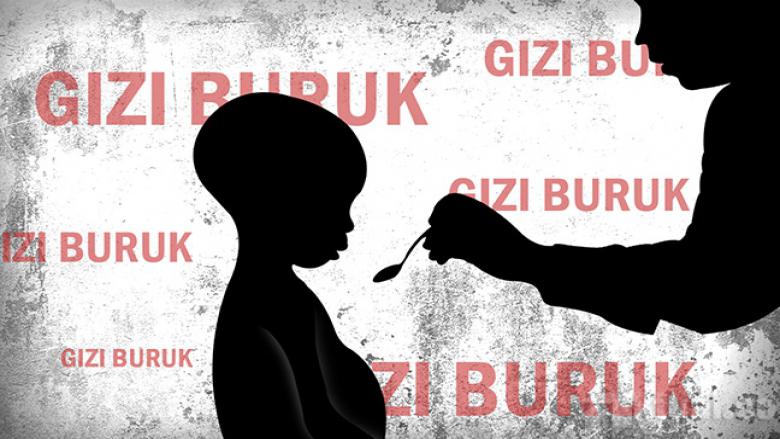 Ternyata ada 4 Kasus Gizi Buruk di Kota Pekanbaru