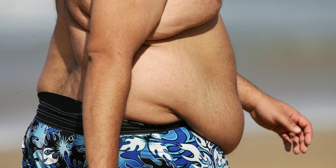 Empat Faktor yang Bisa Menyebabkan Perut Membuncit dan Cara Mengecilkannya