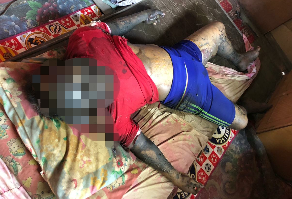 Pria Paruh Baya Penarik Becak Ditemukan Meninggal di Kamar Rumahnya