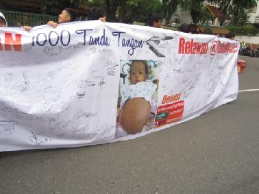 Nyfara Butuh Bantuan Dana Rp 1,5 M