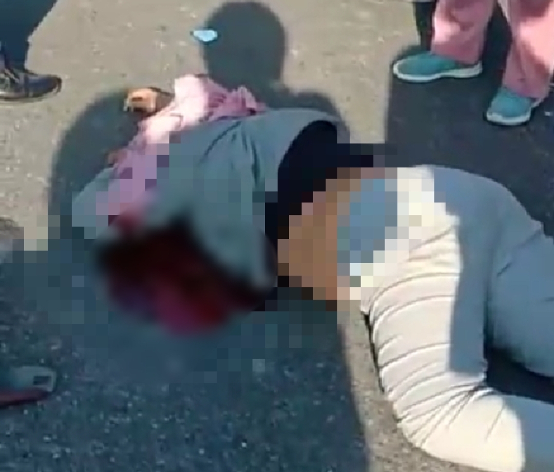 Kecelakaan di Bundaran Tugu Songket, Pengendara Sepeda Motor Meninggal Dunia Ditempat