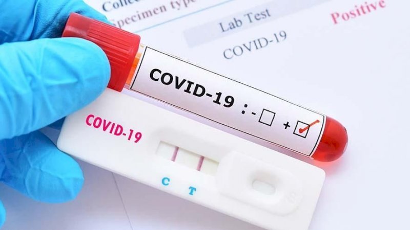 Wah.. Ahli Peringatkan Covid-19 Bisa Sebabkan Disfungsi Ereksi