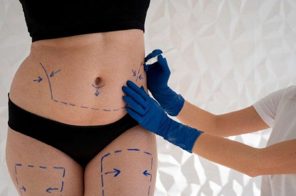 Apa Boleh Lakukan Body Contouring Pasca Melahirkan?
