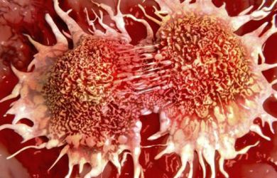 7 Buah dan Sayur Ini Ampuh Membunuh Sel Kanker Dalam Tubuh