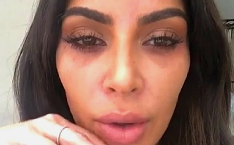 Berikut Tips Menghilangkan Lingkaran Hitam Mata, Dicoba Yuk!