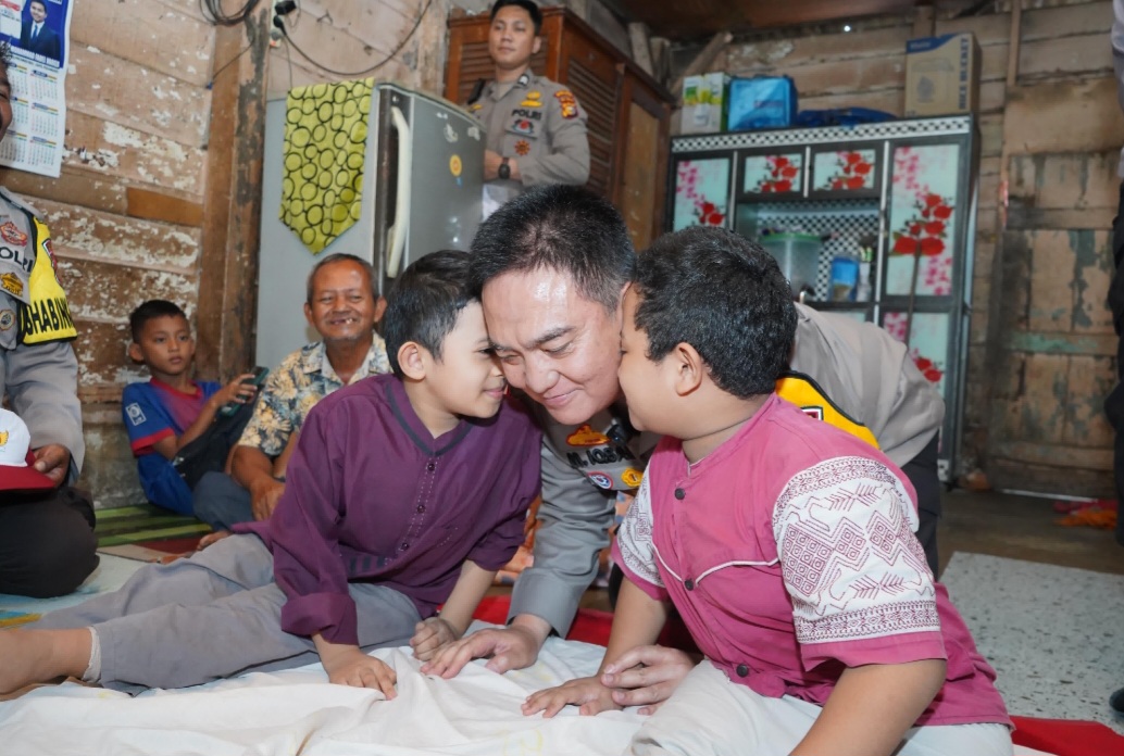 Dibiayai Kapolda Riau, Adik-Kakak Penderita Tulang Kaca Berangsur Pulih