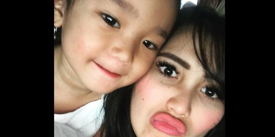 Ayu Ting Ting Pamer Bibir Tebal Menantang, Netizen Mendadak Ingin Jadi Ayah Bilqis
