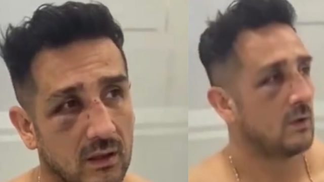 Pesinetron Claudio Martinez Dikeroyok, Pelipis Mata Lebam, Begini Kronologisnya