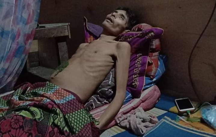 Derita Liver, Kasdi Warga Pekanbaru Butuh Bantuan Para Dermawan