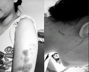 Korban Penganiayaan Oknum Polwan Dilaporkan ke Polda Riau Terkait UU ITE