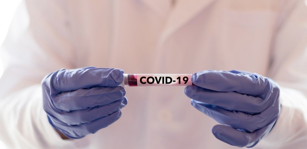 Diantara 8 Orang Dinyatakan Positif COVID-19 Kemaren, 1 Diantaranya Warga Kecamatan Minas