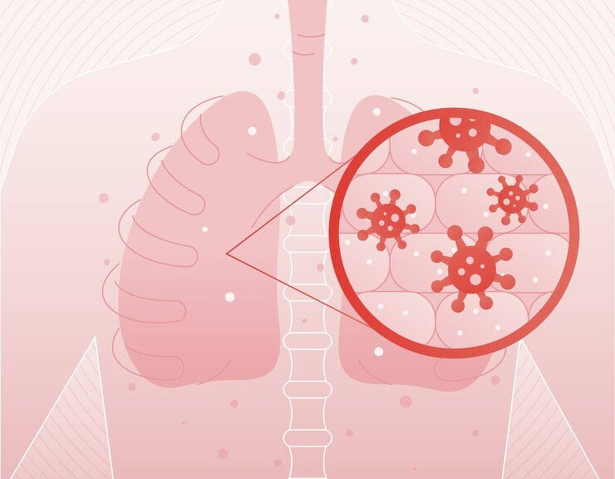 Paparan Kipas Angin Bisa Picu Pneumonia, Mitos atau Fakta ?