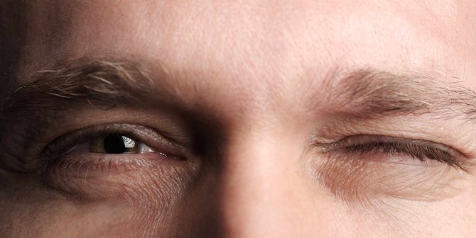 Arti Kedutan Mata, Bisa Ungkap Kondisi Kesehatan Tubuhmumu!