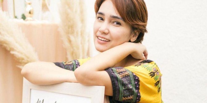 Ini Potret Terbaru Feby Febiola dengan Kepala Botak Usai Lakukan Kemoterapi