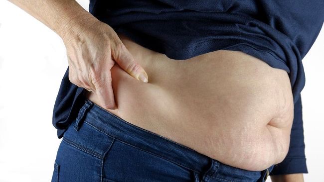 Warga Indonesia Masuk Top Obesitas ASEAN, Ternyata Ini Penyebabnya