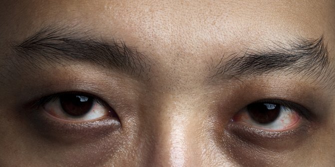 Lima Cara Menjaga Kesehatan Mata Seiring Bertambahnya Usia