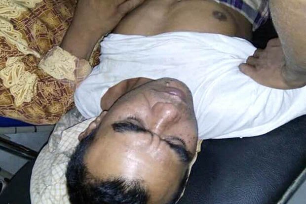 Coba Telusuri Suara Harimau, Arkat Nyaris Tewas Diterkam