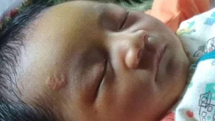 Bayi Lahir dengan Tanda Lafaz Allah di Dahi, Sang Ibu Tak Tahu Kalau Hamil