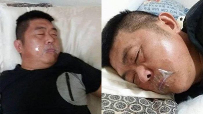 Sayang Istri, Suami Tutup Mulutnya Sendiri dengan Selotip saat Tidur, Anaknya Sampai Terenyuh