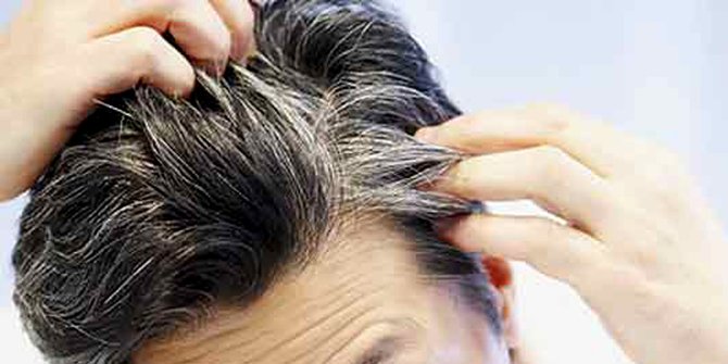 Apa Benar Mencabut Uban Bisa Buat Jumlahnya Malah Bertambah?