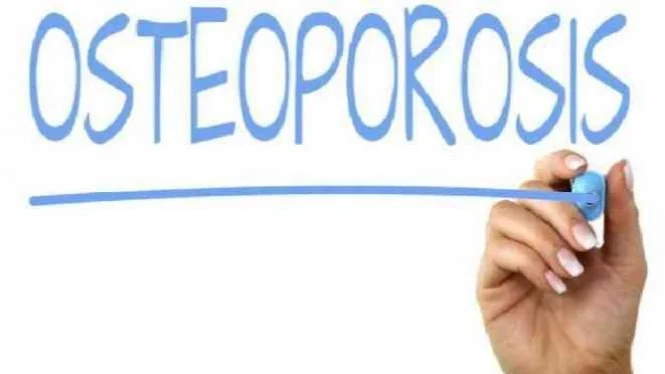 10 Tips Mencegah Osteoporosis