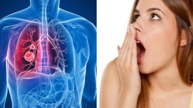 6 Cara Menghilangkan Bau Mulut dalam Sekejap