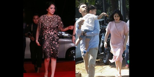 Tak Pernah Disadari Dari Cara Berjalan, Nagita Slavina Memiliki Kelainan