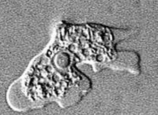 Amoeba Pemakan Otak Ditemukan, Pasien Bisa Meninggal dalam Sepekan