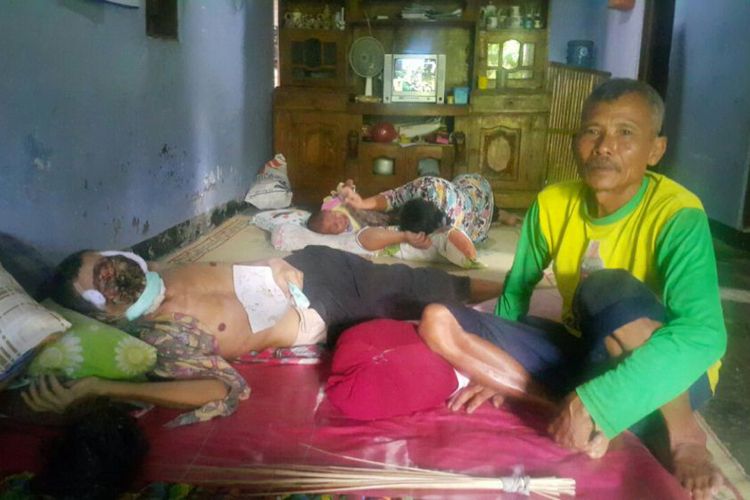 Kisah Tragis Penjual Sayur, Mukanya Hilang Setelah 4 Tahun Terkena Kanker Kulit