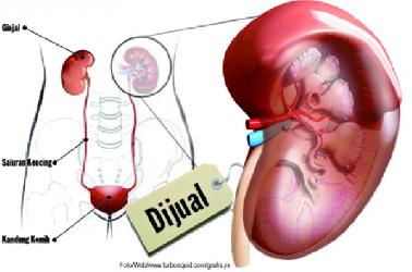 Tebus Ijazah Anaknya, Sugiyanto Rela Jual Ginjalnya