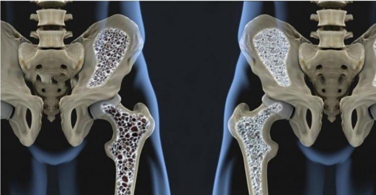 Mager Bisa Bikin Tulang KeroposPaul Munster: Ada yang Bilang Kami Main dengan Wasit